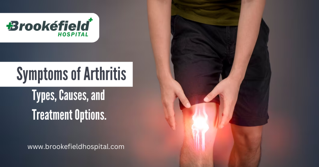 Symptoms of Arthritis