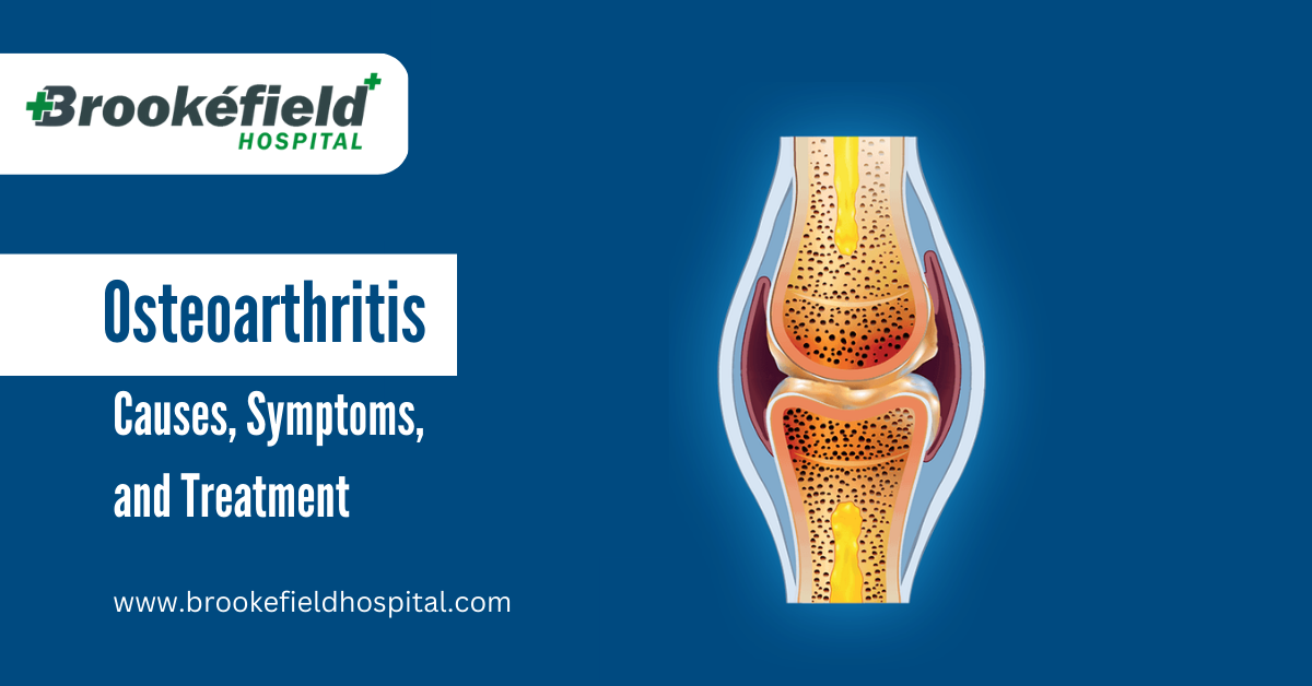 Osteoarthritis