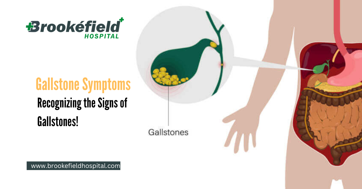 Gallstone Symptoms